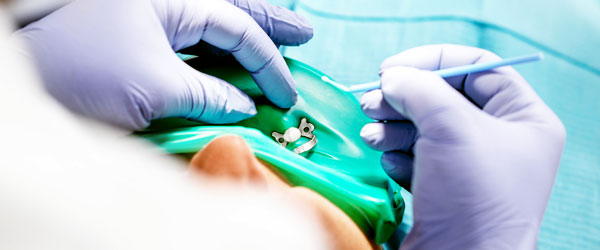 Dental hygienist performing a dental cleaning for a patient